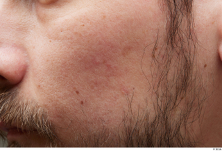 HD Face Skin Nigel cheek face skin pores skin texture…